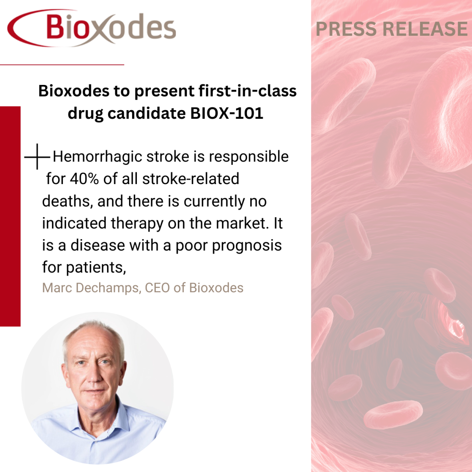 Bioxodes to present first-in-class drug candidate BIOX-101 for hemorrhagic stroke to investors and pharmaceutical community in range of conferences