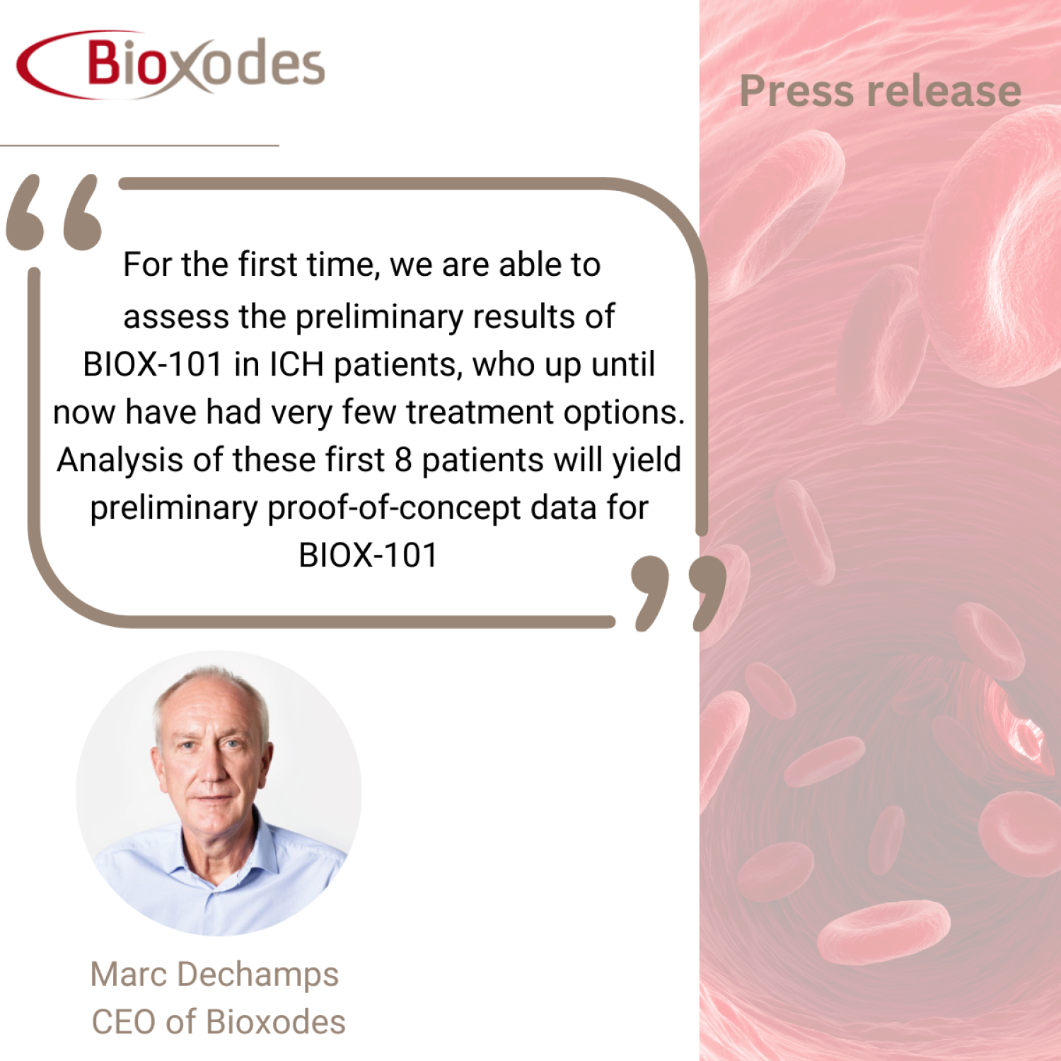 Bioxodes meets first Phase 2a patient enrollment milestone with BIOX-101 in intracerebral hemorrhagic stroke