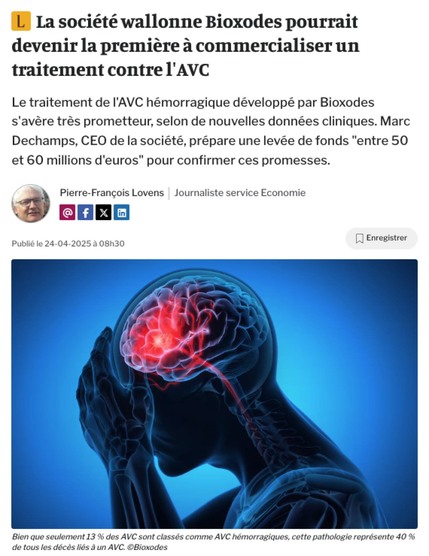 La société wallonne Bioxodes pourrait devenir la première à commercialiser un traitement contre l'AVC