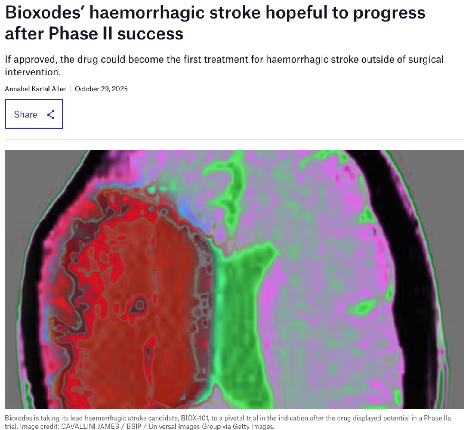 Bioxodes’ haemorrhagic stroke hopeful to progress after Phase II success
